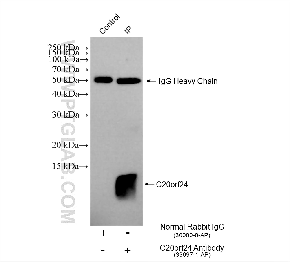 IP experiment of Caco-2 using 33697-1-AP Immunoprecipitation (IP) experiment of Caco-2 cells using RAB5IF Polyclonal antibody (33697-1-AP)