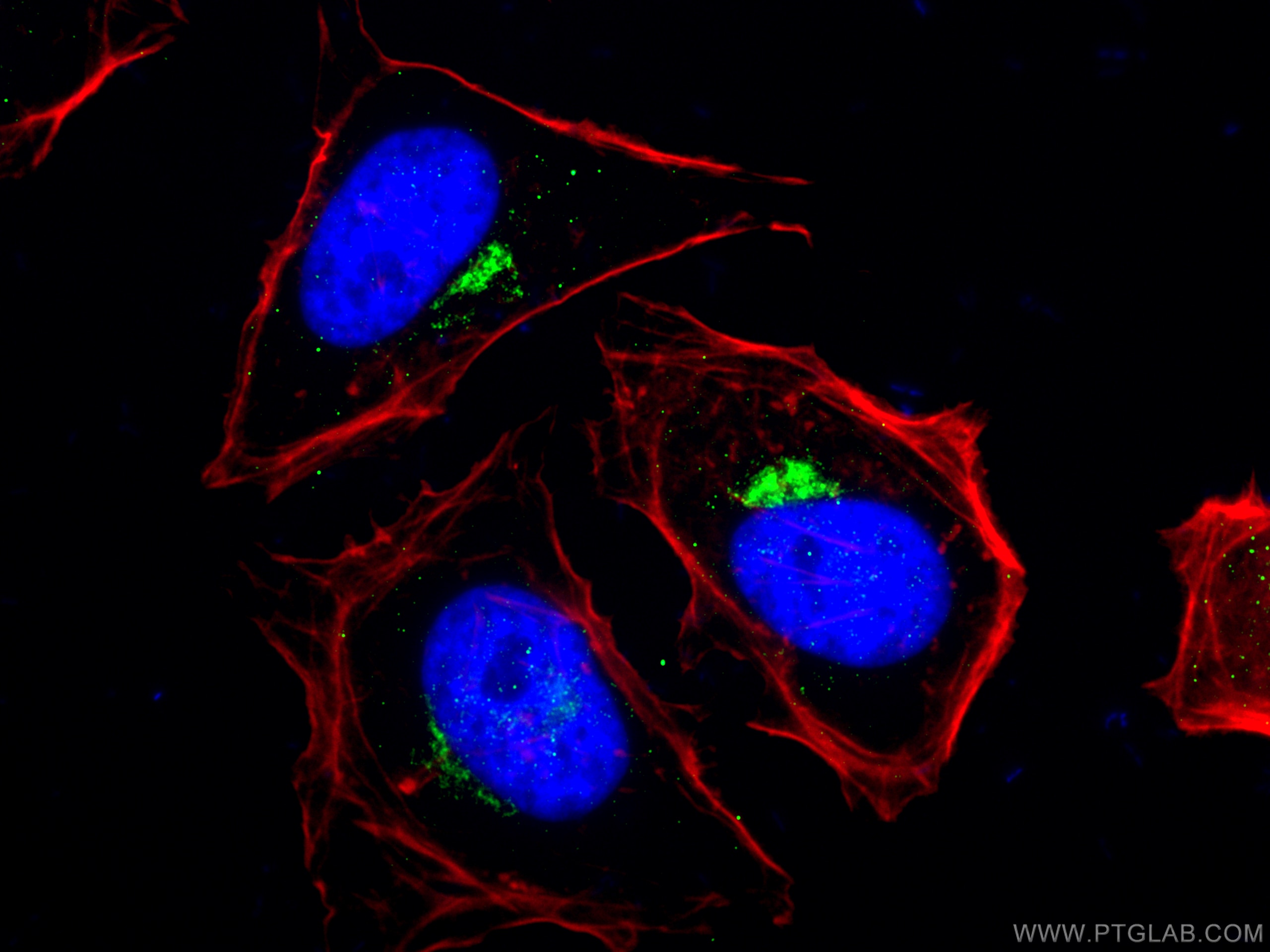 Immunofluorescence (IF) / fluorescent staining of HeLa cells using RAB6A Polyclonal antibody (10187-2-AP)