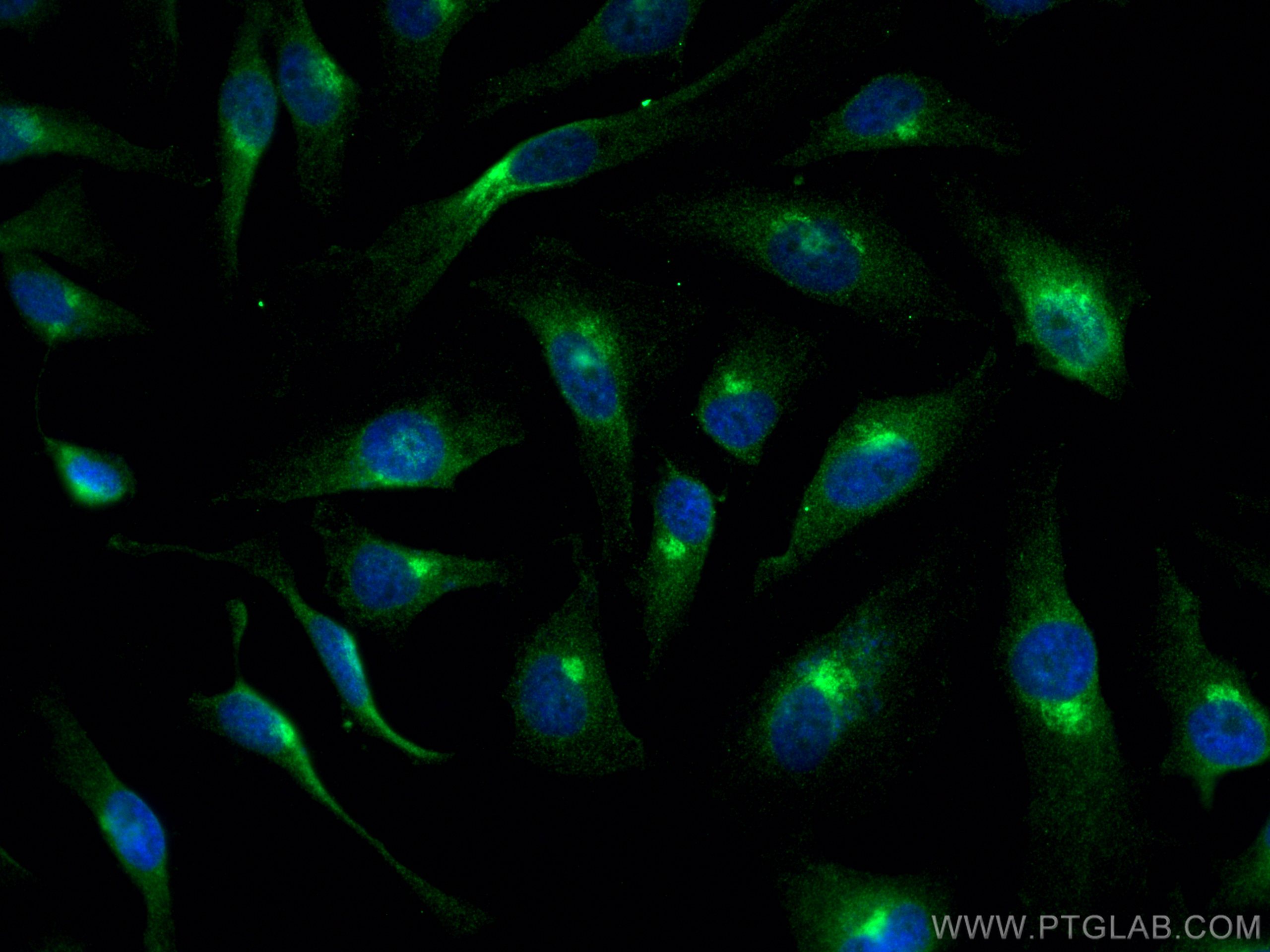 IF Staining of HeLa using 10187-2-AP