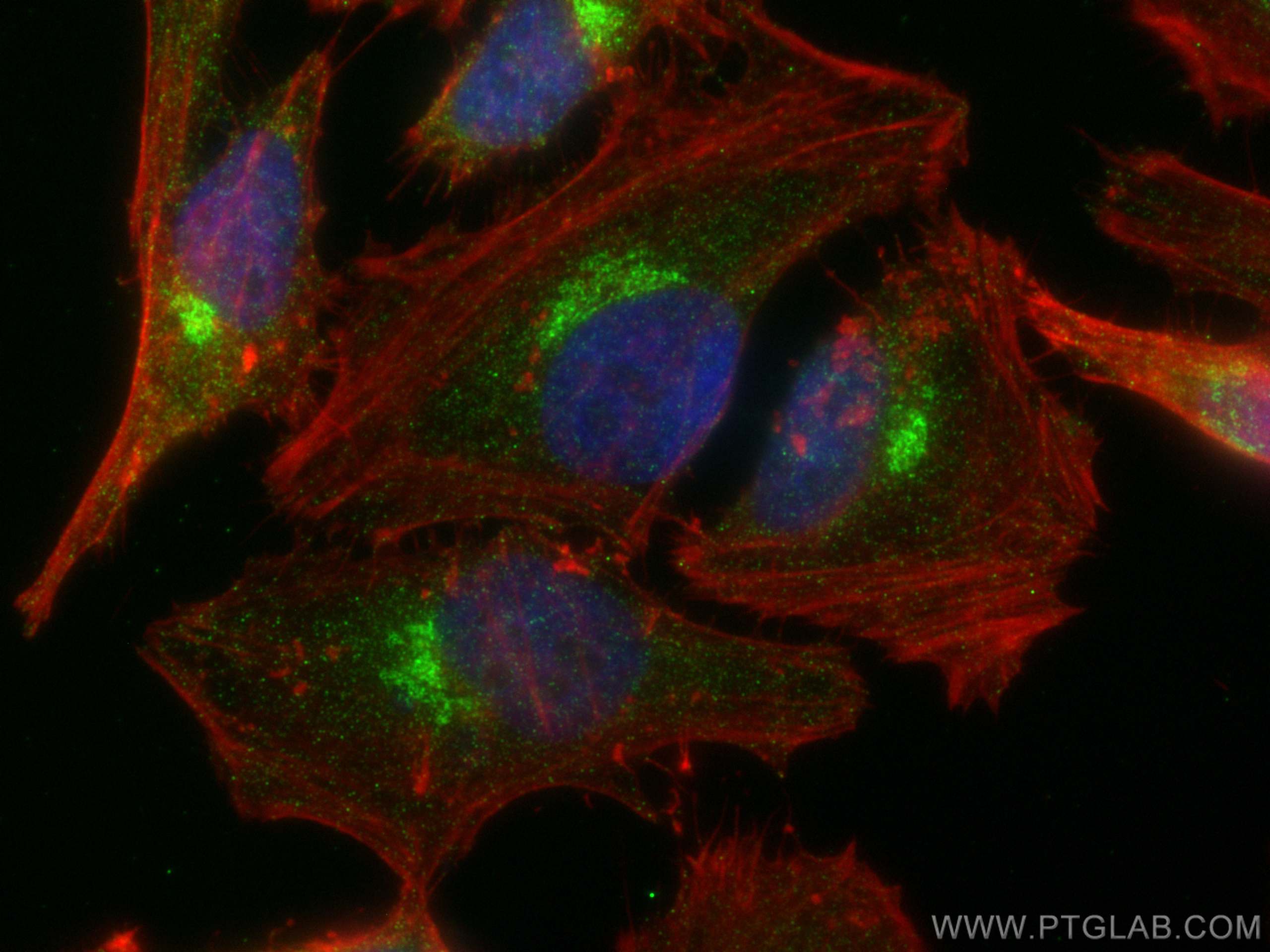 Immunofluorescence (IF) / fluorescent staining of HeLa cells using RAB6A Polyclonal antibody (10187-2-AP)