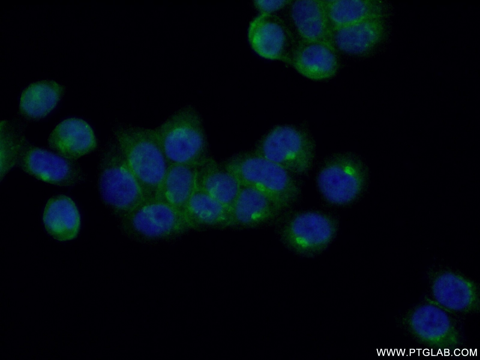 IF Staining of HeLa using 10187-2-AP