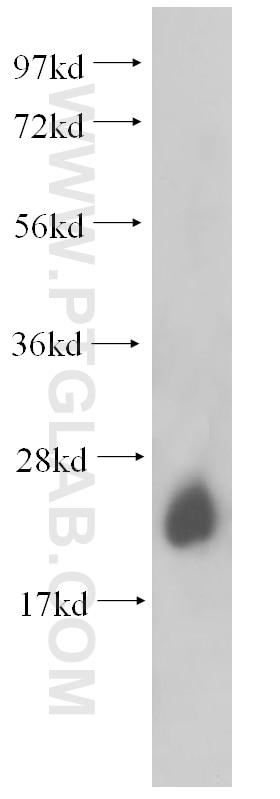 RAB6A Polyclonal antibody