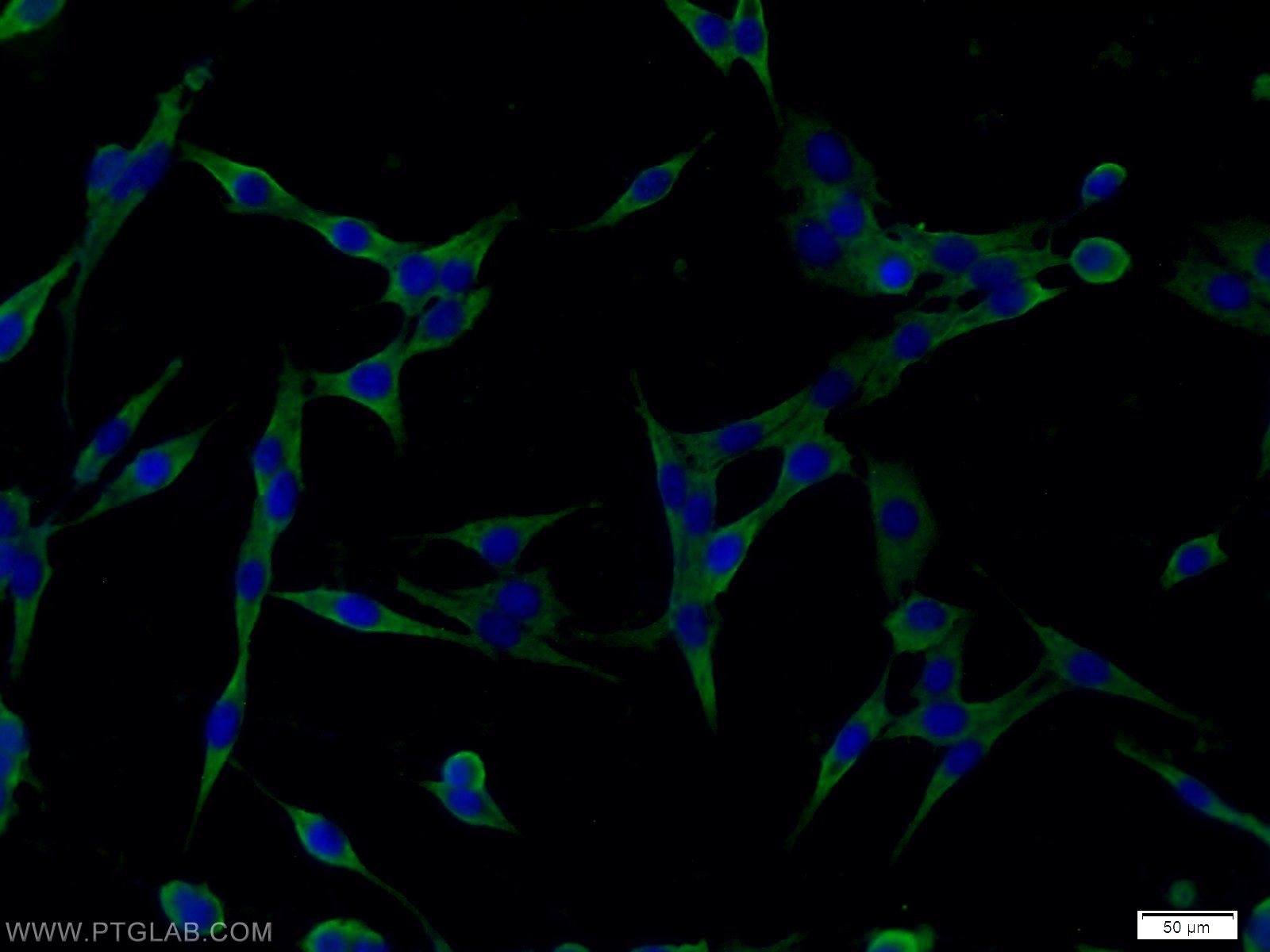Immunofluorescence (IF) / fluorescent staining of C6 cells using RAB6B Polyclonal antibody (10340-1-AP)