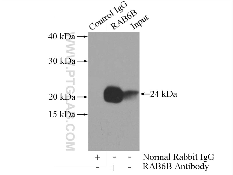 Immunoprecipitation (IP) experiment of mouse brain tissue using RAB6B Polyclonal antibody (10340-1-AP)