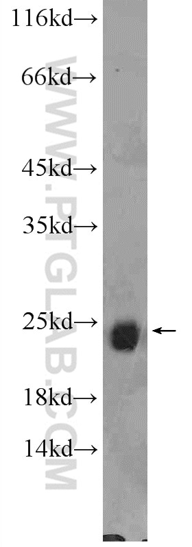 Western Blot (WB) analysis of rat brain tissue using RAB6B Polyclonal antibody (10340-1-AP)