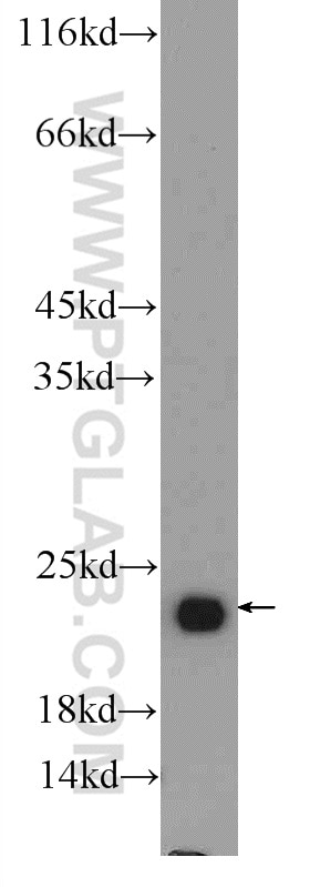 Western Blot (WB) analysis of C6 cells using RAB6B Polyclonal antibody (10340-1-AP)