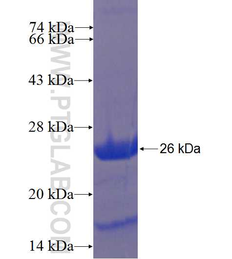 RAB6B fusion protein Ag22626 SDS-PAGE