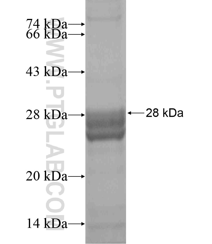 RAB6C fusion protein Ag18564 SDS-PAGE