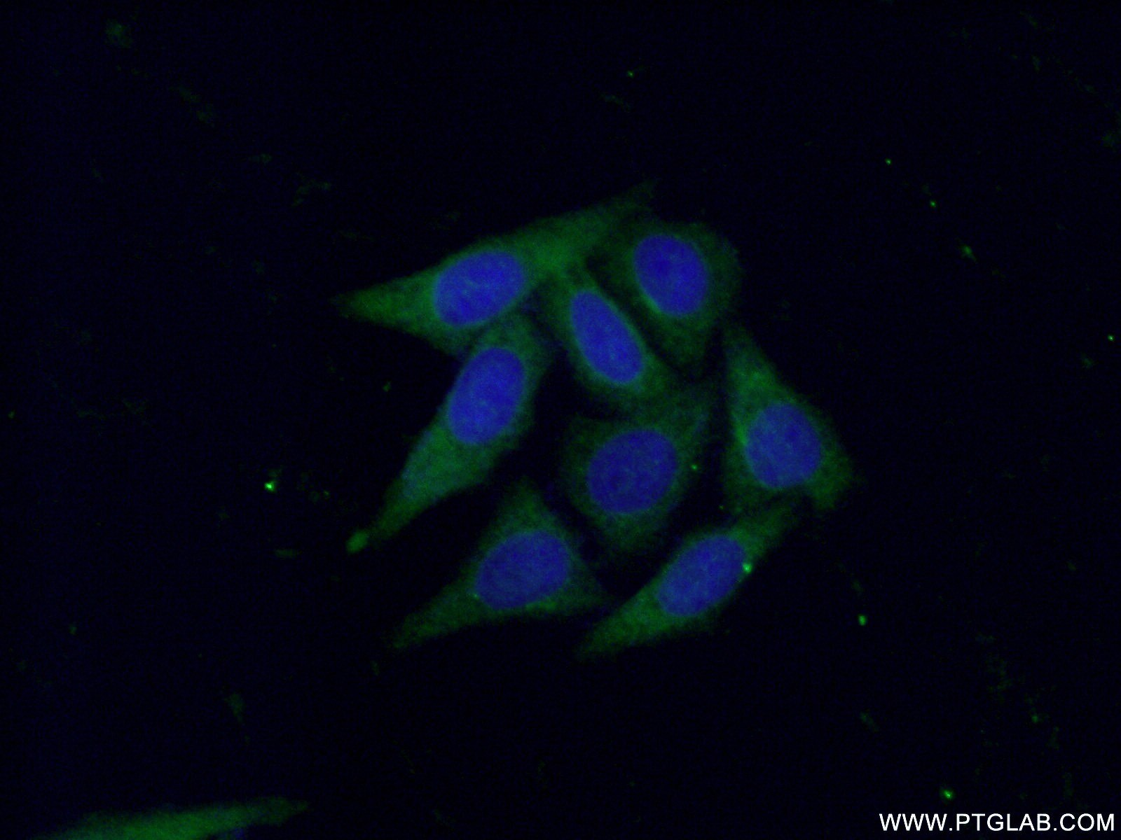 RAB7A Polyclonal antibody