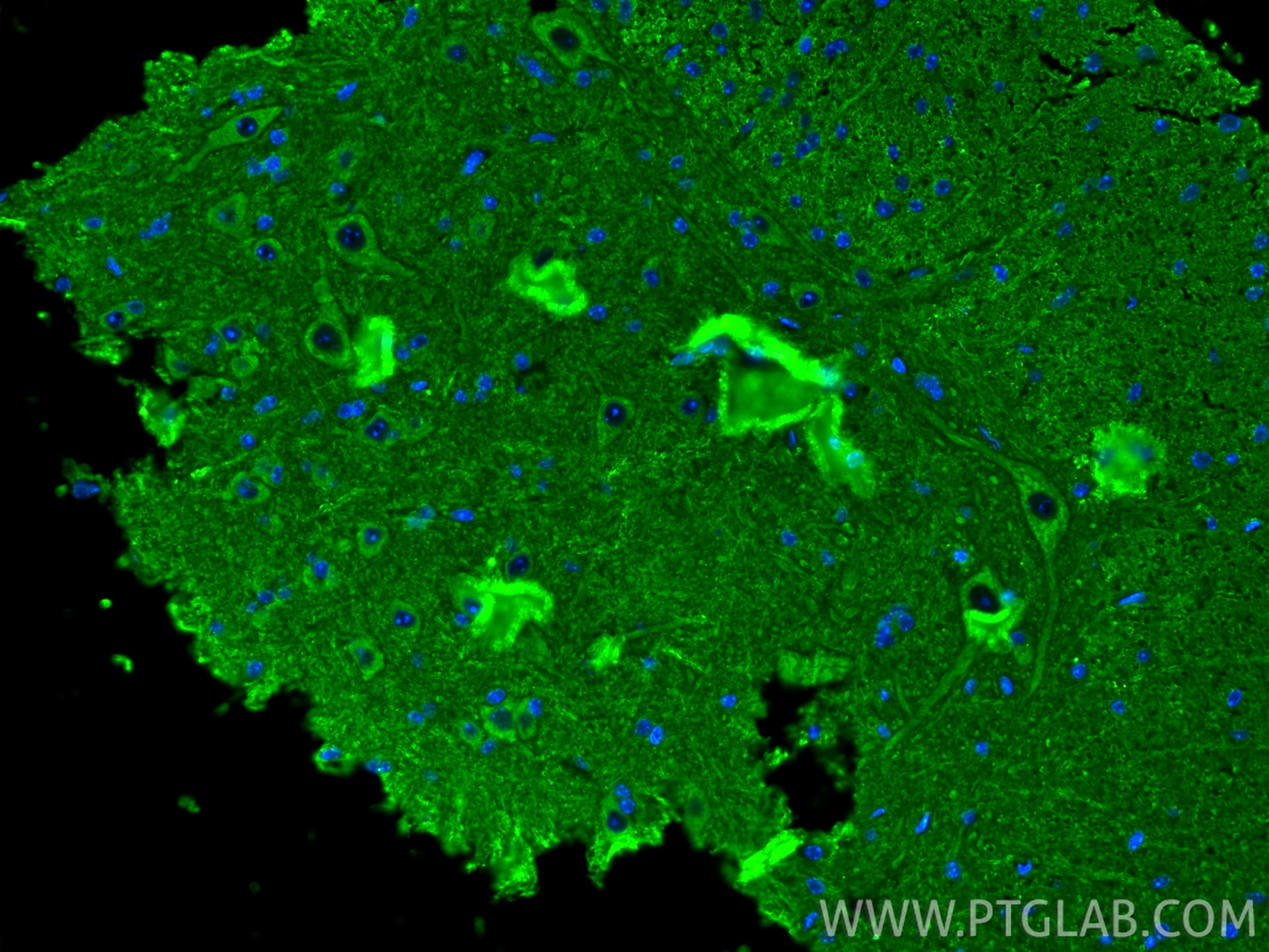 Immunofluorescence (IF) / fluorescent staining of mouse spinal cord tissue using RAB7A Polyclonal antibody (55469-1-AP)