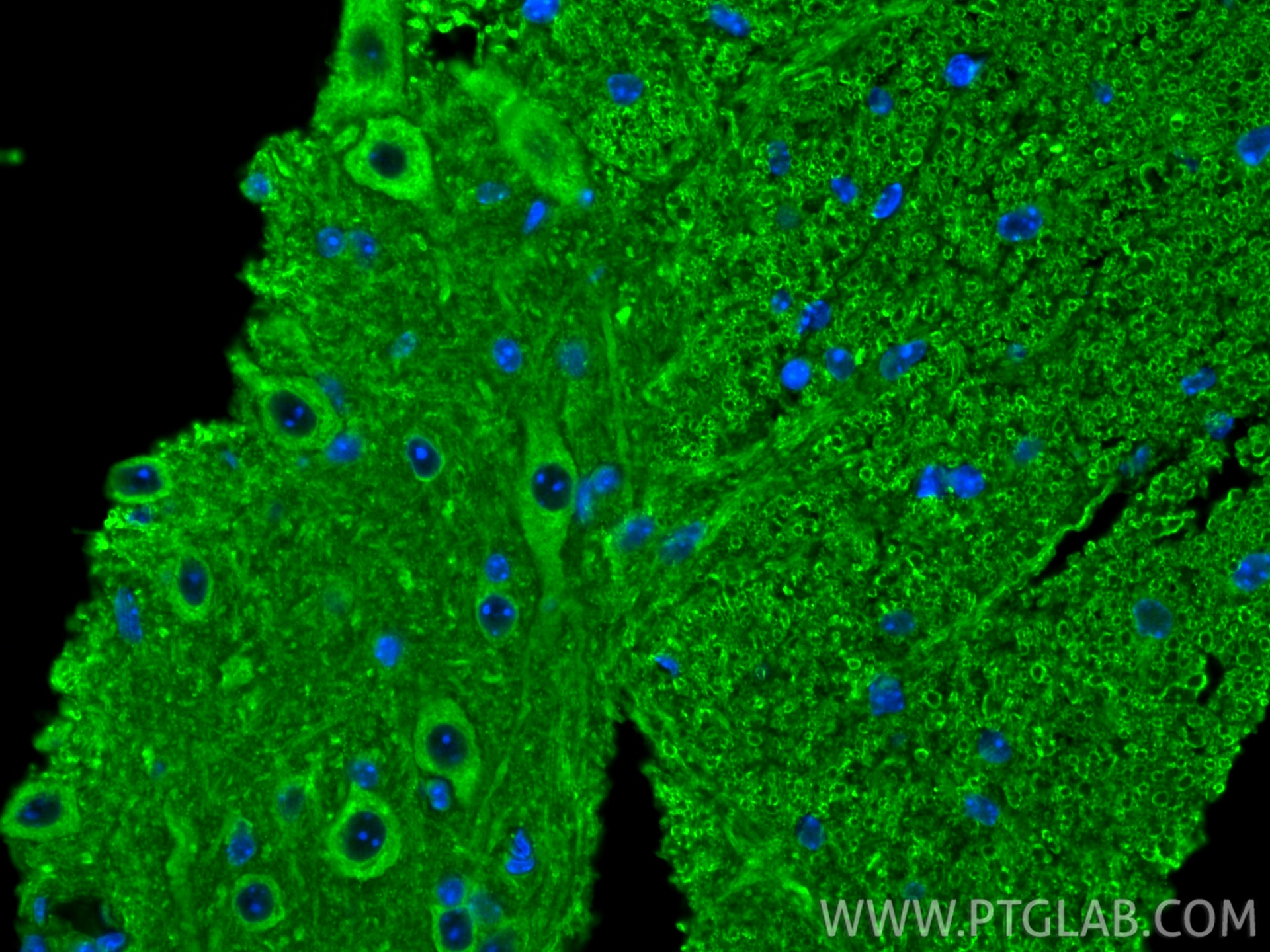 Immunofluorescence (IF) / fluorescent staining of mouse spinal cord tissue using RAB7A Polyclonal antibody (55469-1-AP)