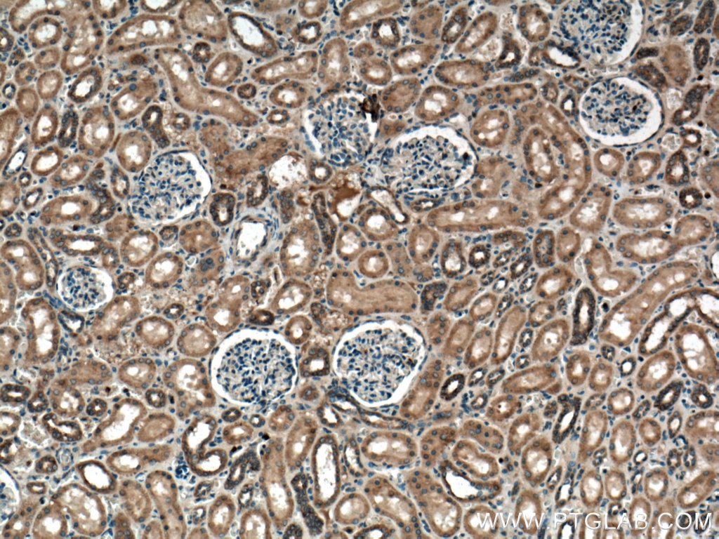 Immunohistochemistry (IHC) staining of human kidney tissue using RAB7A Polyclonal antibody (55469-1-AP)