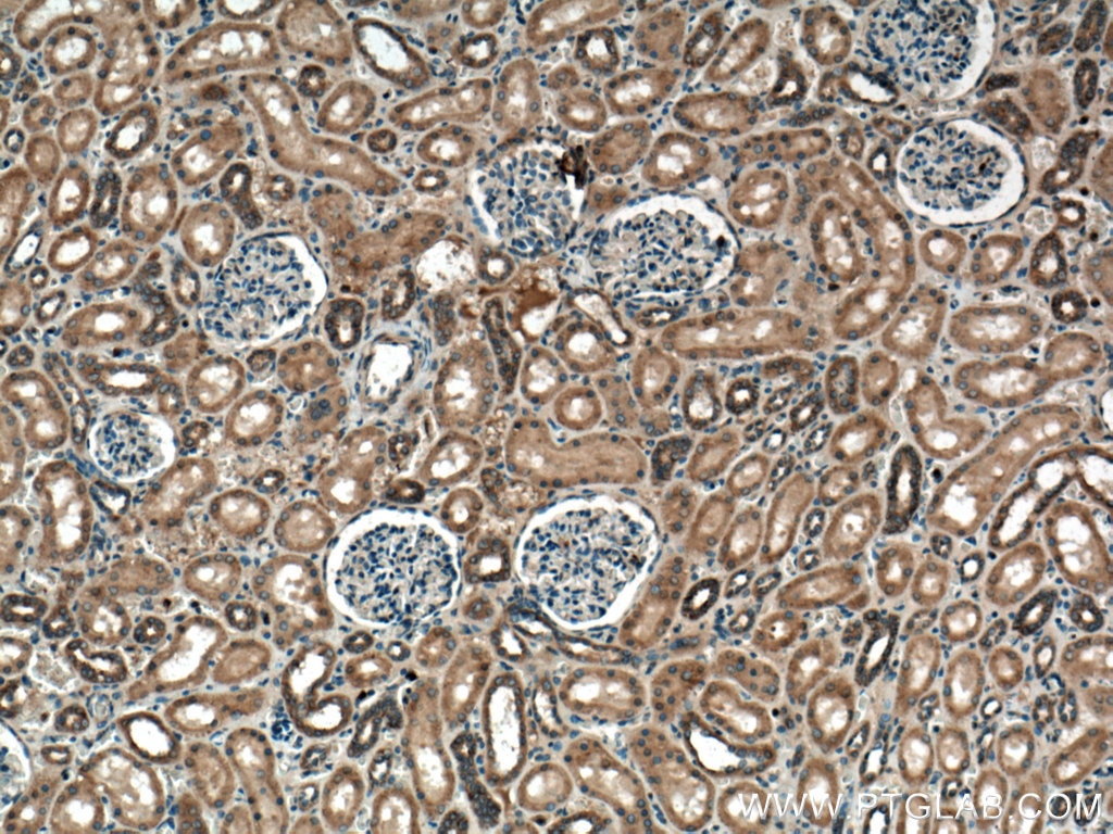 IHC staining of human kidney using 55469-1-AP