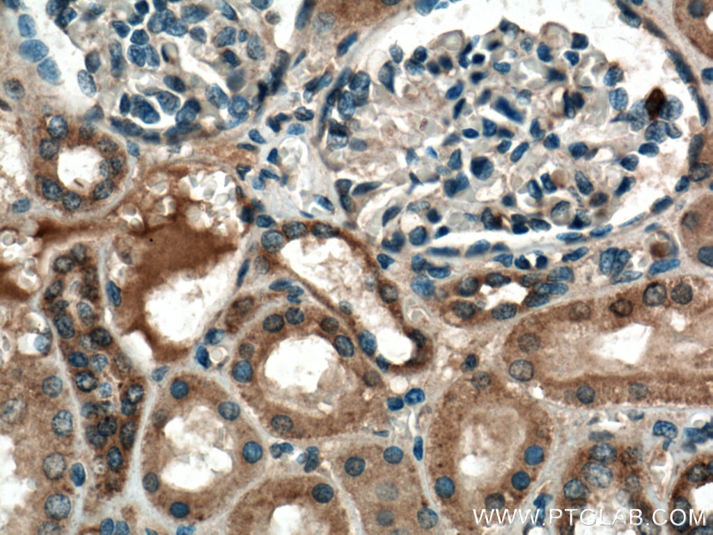 Immunohistochemistry (IHC) staining of human kidney tissue using RAB7A Polyclonal antibody (55469-1-AP)