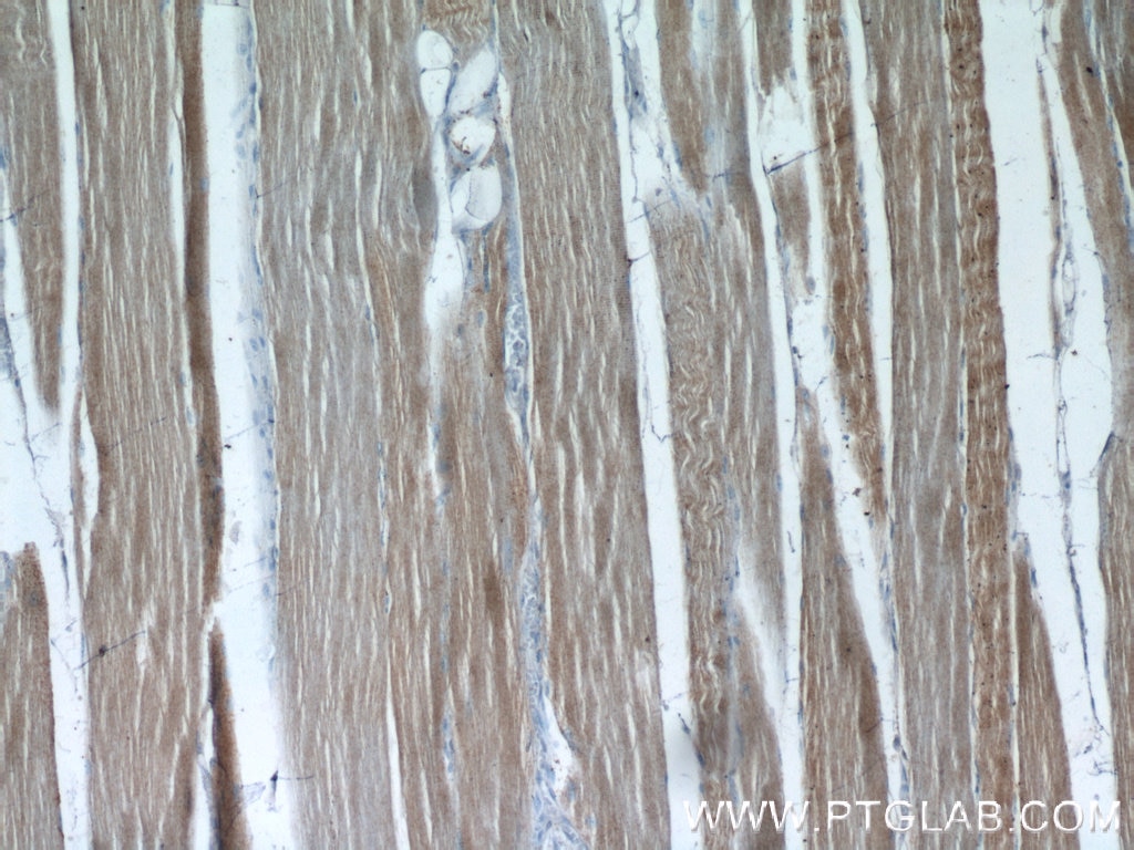 Immunohistochemistry (IHC) staining of human skeletal muscle tissue using RAB7A Polyclonal antibody (55469-1-AP)