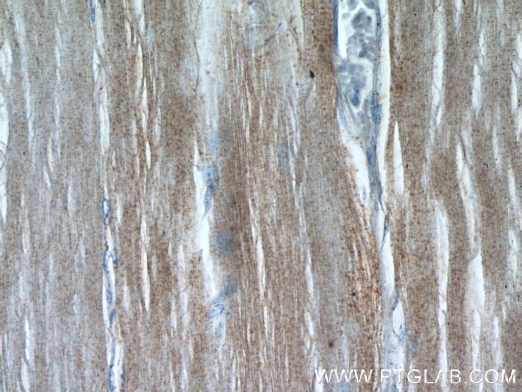 Immunohistochemistry (IHC) staining of human skeletal muscle tissue using RAB7A Polyclonal antibody (55469-1-AP)