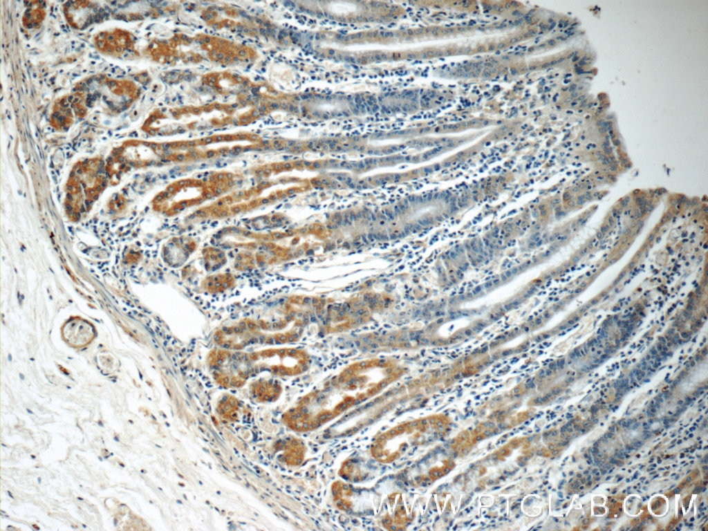 Immunohistochemistry (IHC) staining of human stomach tissue using RAB7A Polyclonal antibody (55469-1-AP)
