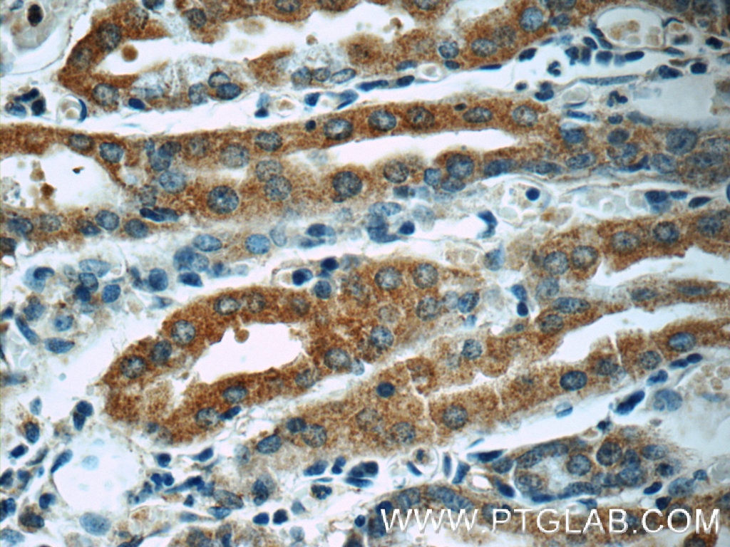 IHC staining of human stomach using 55469-1-AP