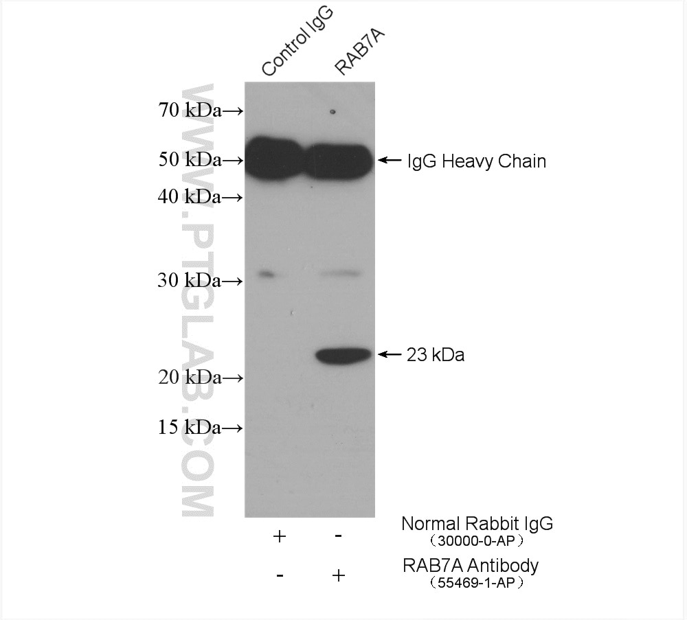 Immunoprecipitation (IP) experiment of SH-SY5Y cells using RAB7A Polyclonal antibody (55469-1-AP)