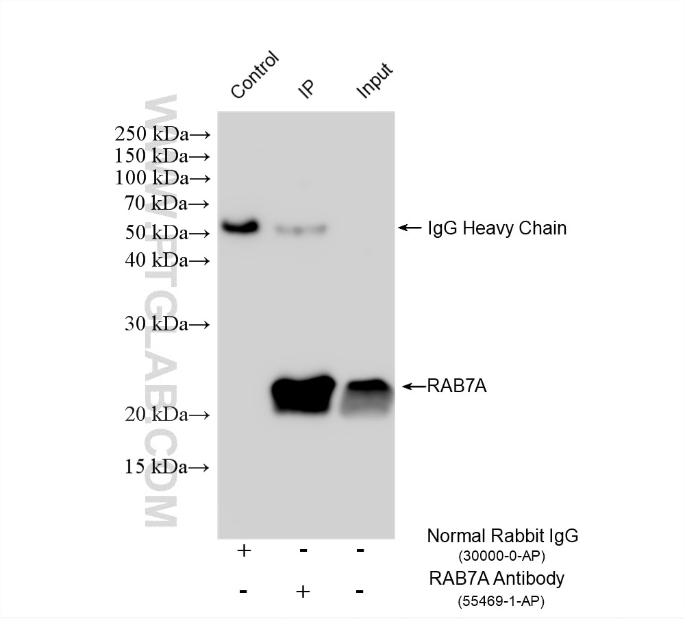Immunoprecipitation (IP) experiment of A431 cells using RAB7A Polyclonal antibody (55469-1-AP)