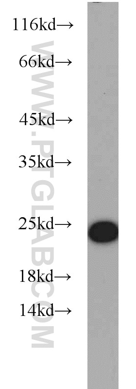 Western Blot (WB) analysis of NIH/3T3 cells using RAB7A Polyclonal antibody (55469-1-AP)
