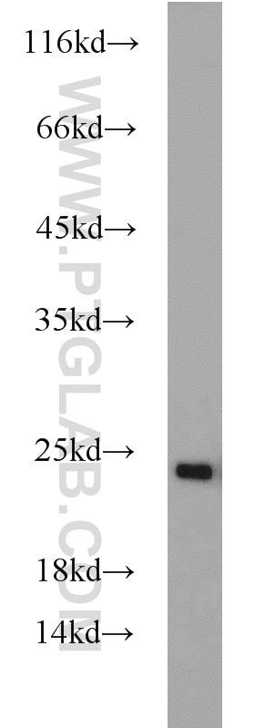 Western Blot (WB) analysis of SH-SY5Y cells using RAB7A Polyclonal antibody (55469-1-AP)