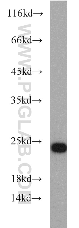 RAB7A Polyclonal antibody
