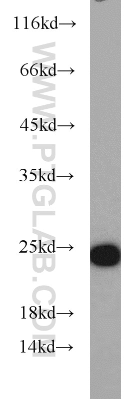 Western Blot (WB) analysis of A431 cells using RAB7A Polyclonal antibody (55469-1-AP)