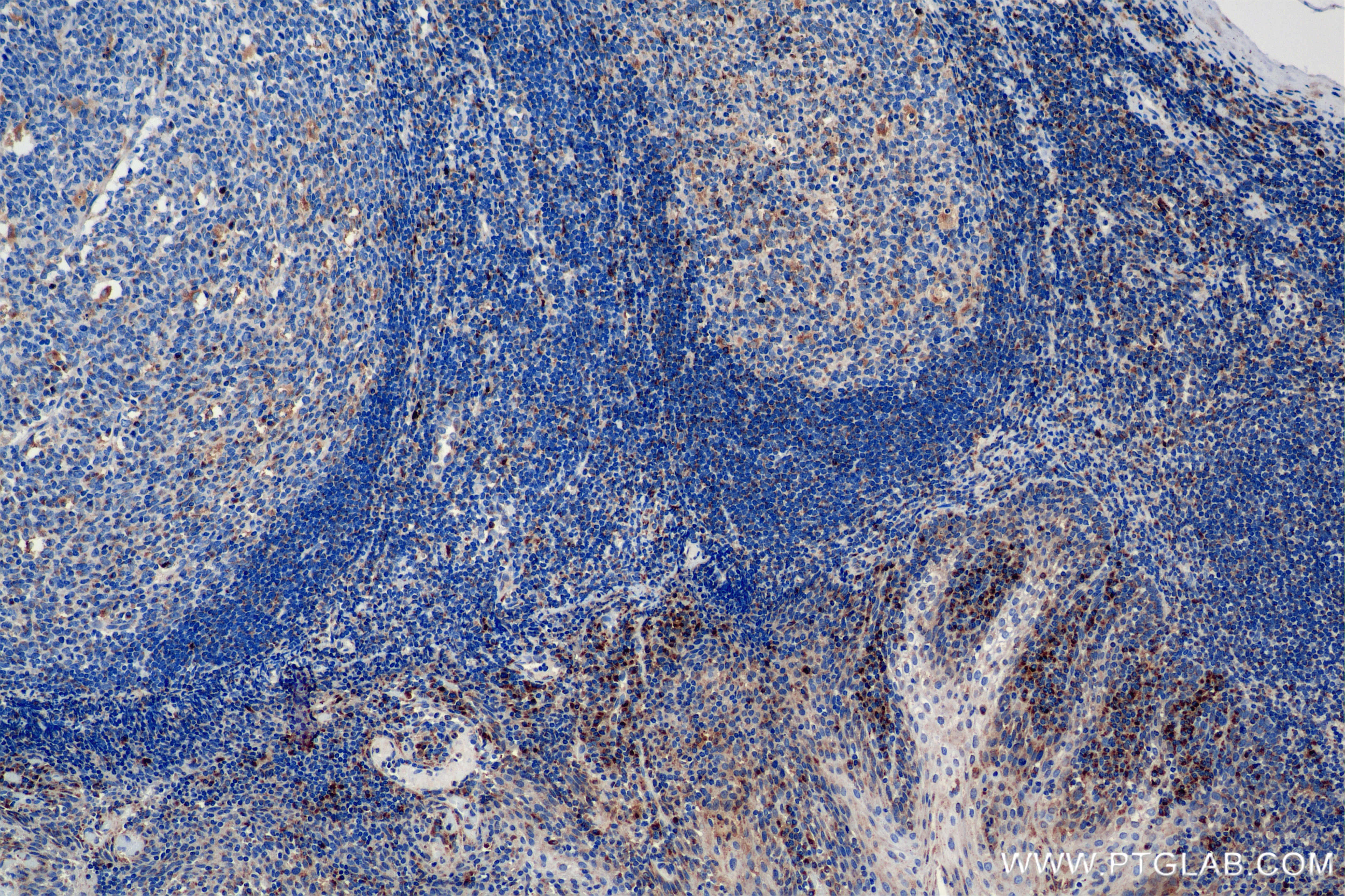 Immunohistochemical analysis of paraffin-embedded human tonsil tissue slide using 84741-1-RR (RAB7A antibody) at dilution of 1:1000 (under 10x lens). Heat mediated antigen retrieval with Tris-EDTA buffer (pH 9.0). Immunohistochemistry (IHC) staining of human tonsil tissue using RAB7A Recombinant antibody (84741-1-RR)
