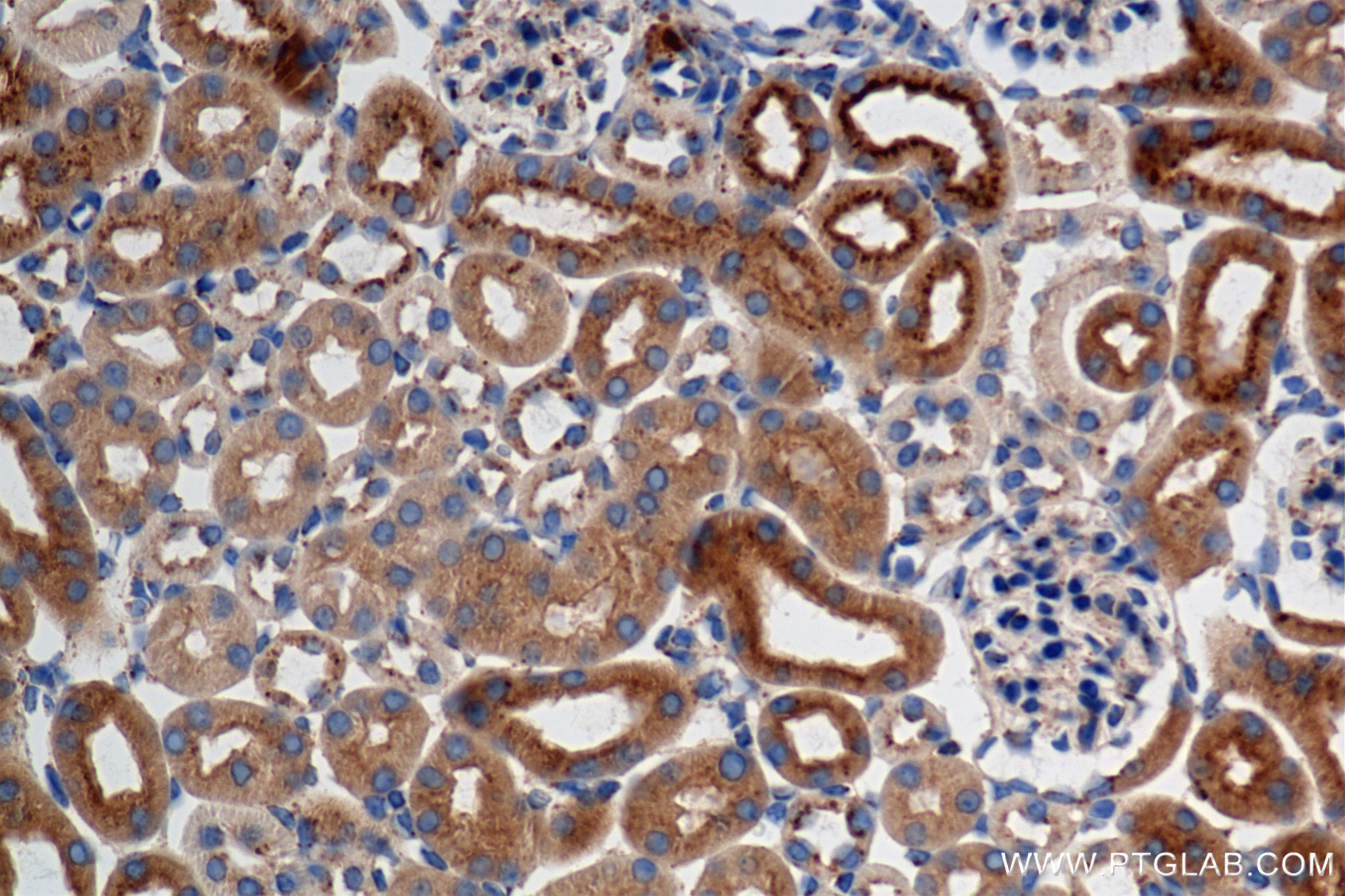 Immunohistochemical analysis of paraffin-embedded mouse kidney tissue slide using 84741-1-RR (RAB7A antibody) at dilution of 1:1000 (under 10x lens). Heat mediated antigen retrieval with Tris-EDTA buffer (pH 9.0). Immunohistochemistry (IHC) staining of mouse kidney tissue using RAB7A Recombinant antibody (84741-1-RR)
