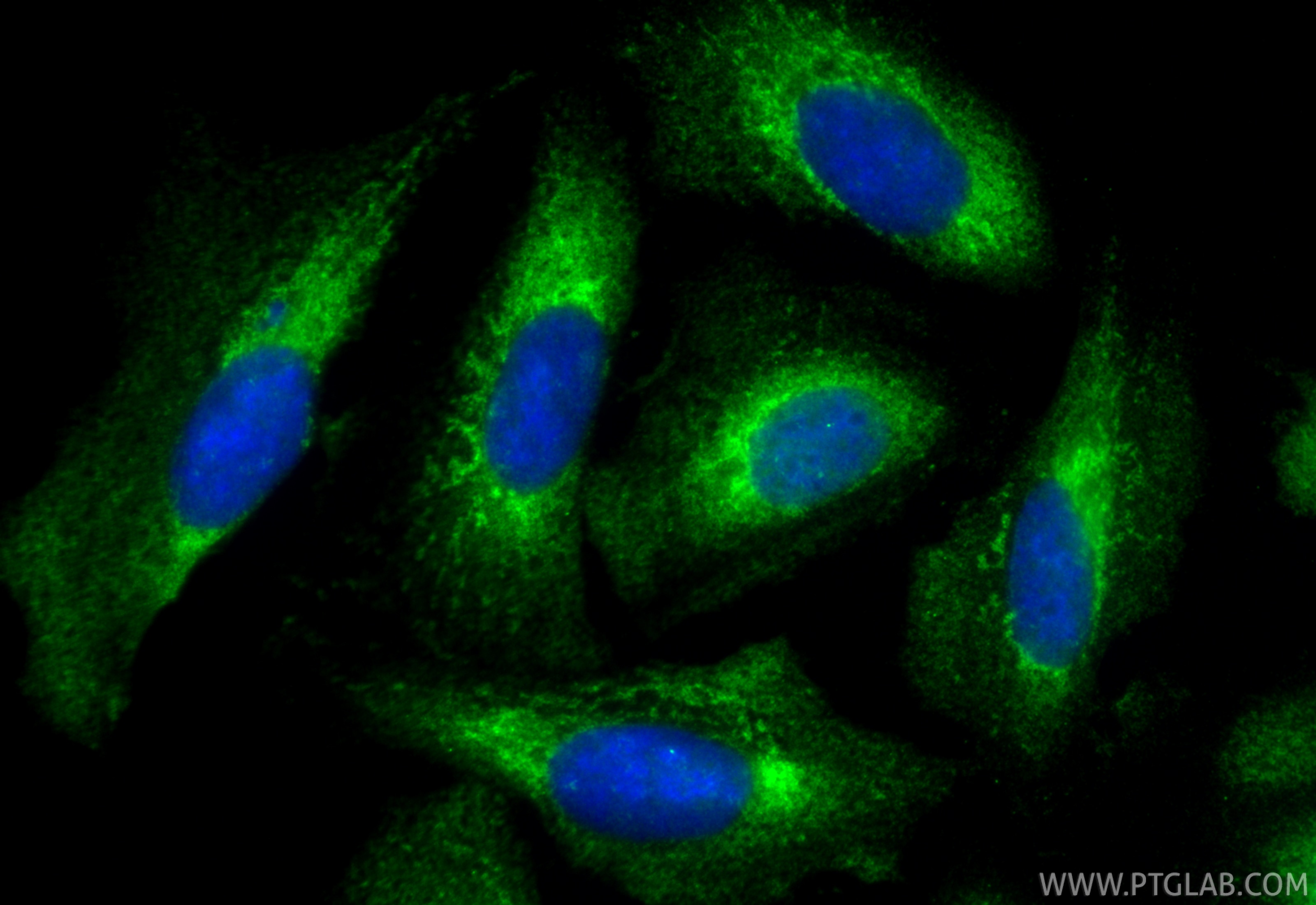 Immunofluorescence (IF) / fluorescent staining of U2OS cells using CoraLite® Plus 488-conjugated RAB7A Polyclonal ant (CL488-55469)