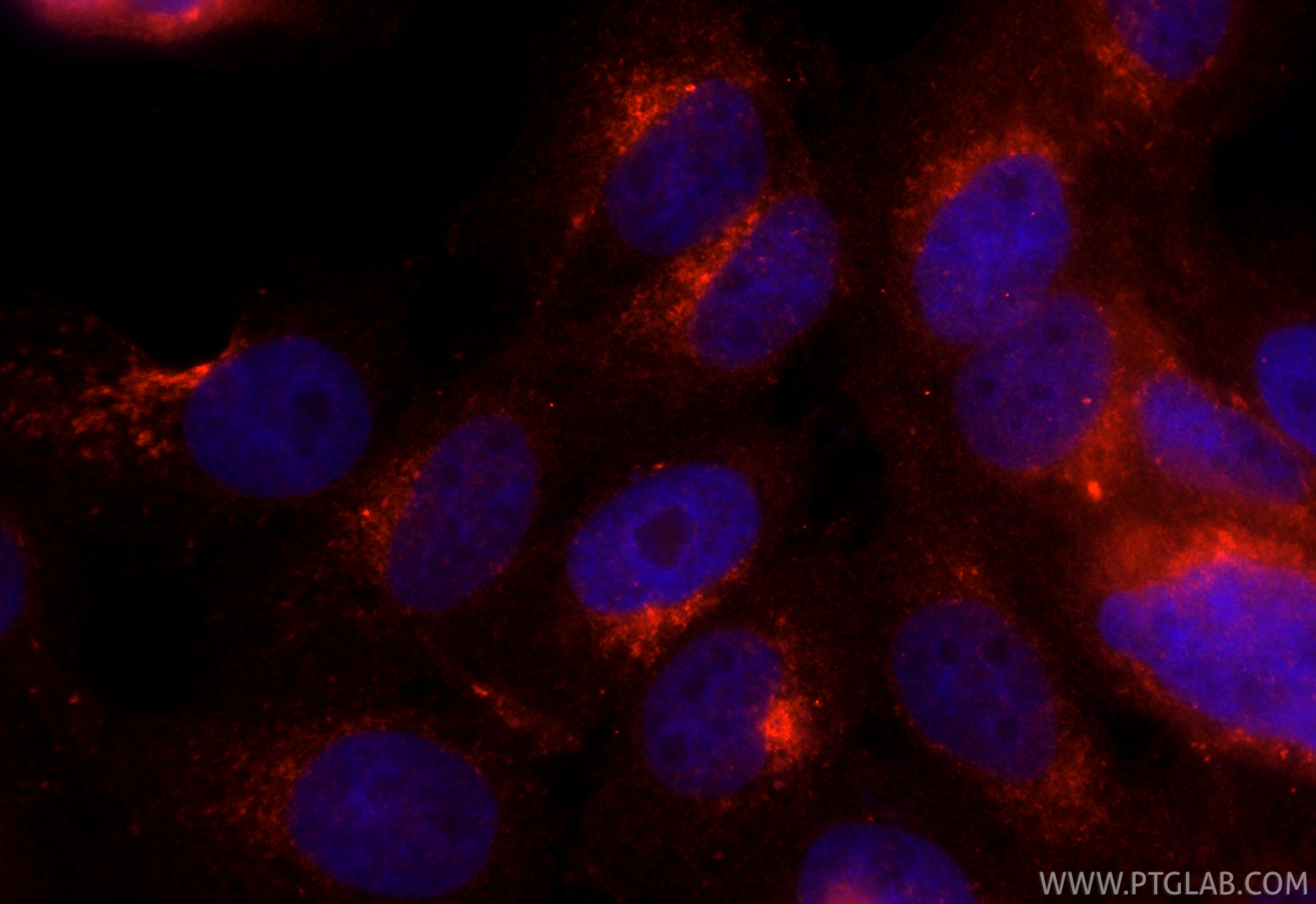 Immunofluorescence (IF) / fluorescent staining of A431 cells using CoraLite®594-conjugated RAB7A Polyclonal antibody (CL594-55469)