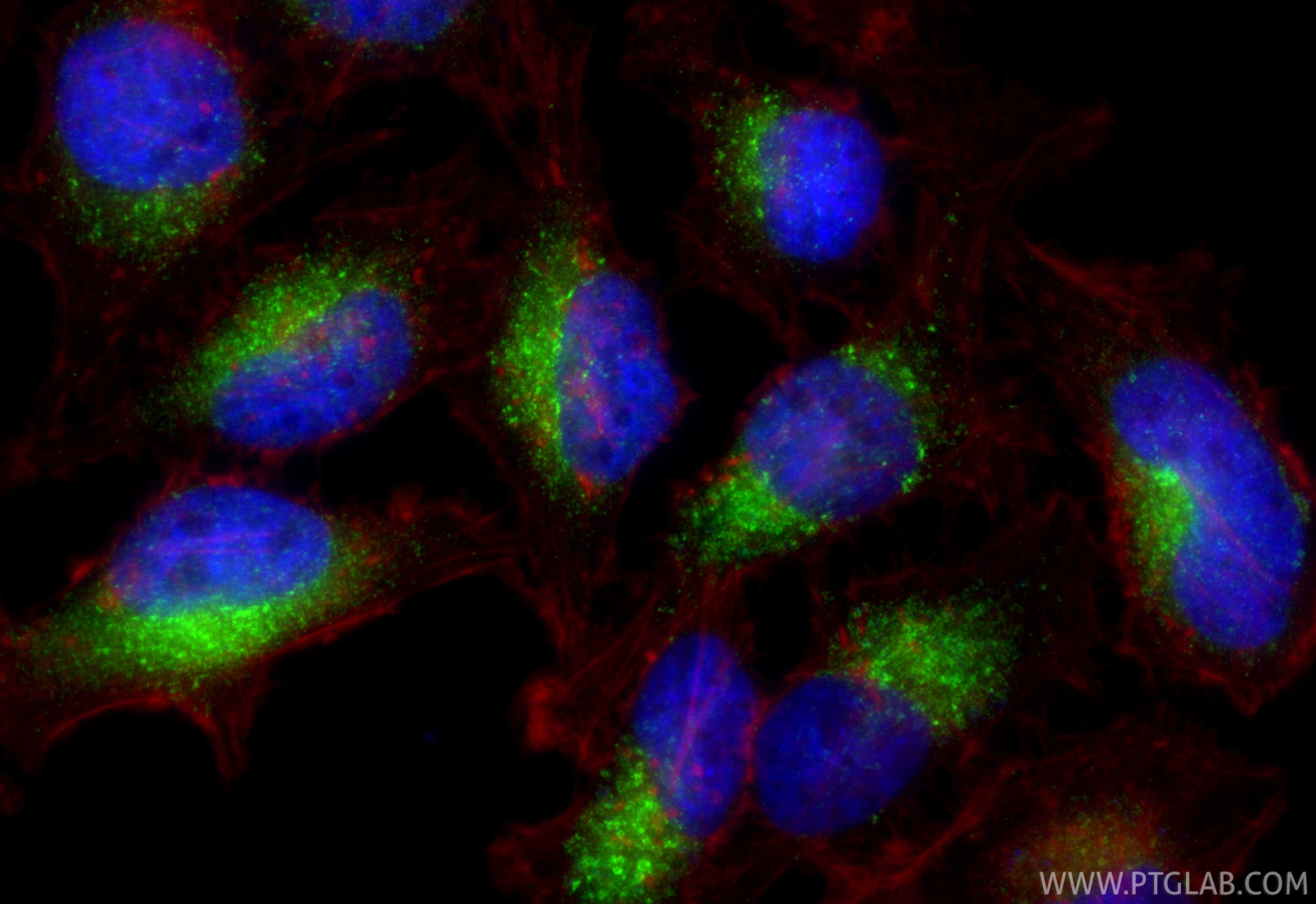 Immunofluorescence (IF) / fluorescent staining of HeLa cells using Multi-rAb™ RAB7A Multi-Recombinant antibody (RMX00029)