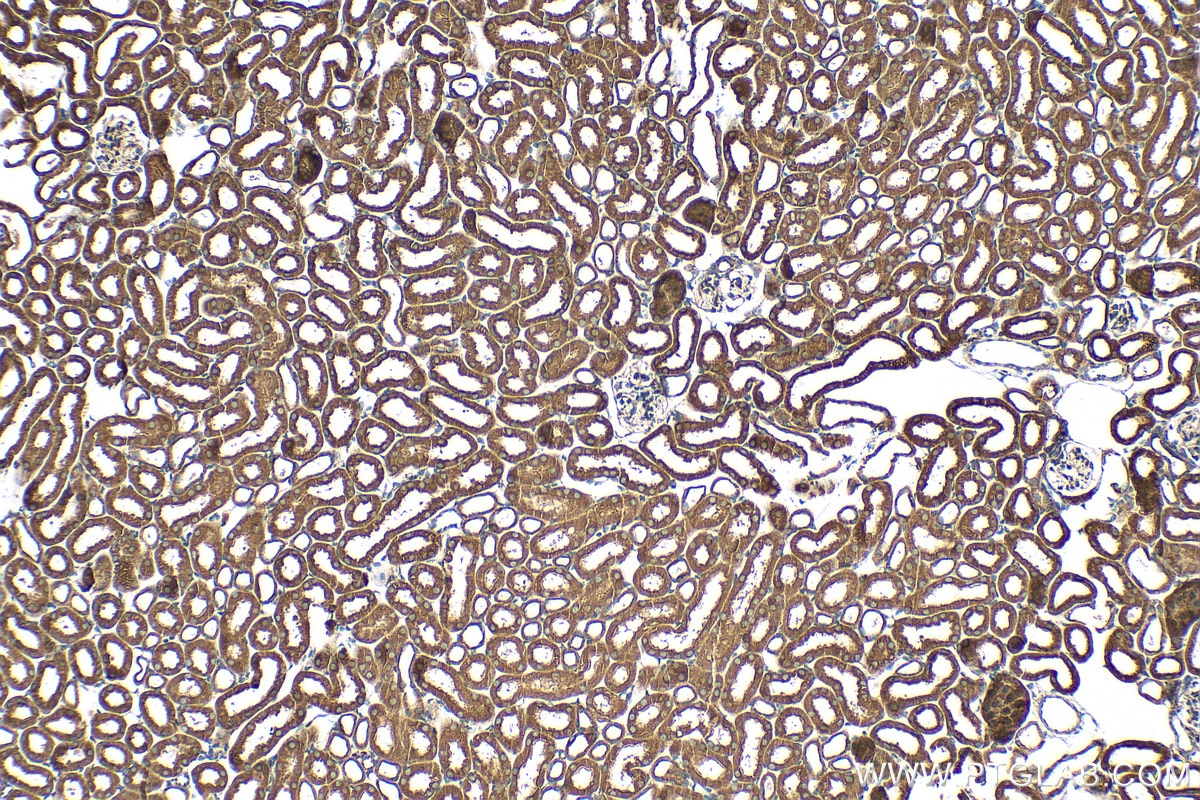 Immunohistochemistry (IHC) staining of mouse kidney tissue using Multi-rAb™ RAB7A Multi-Recombinant antibody (RMX00029)