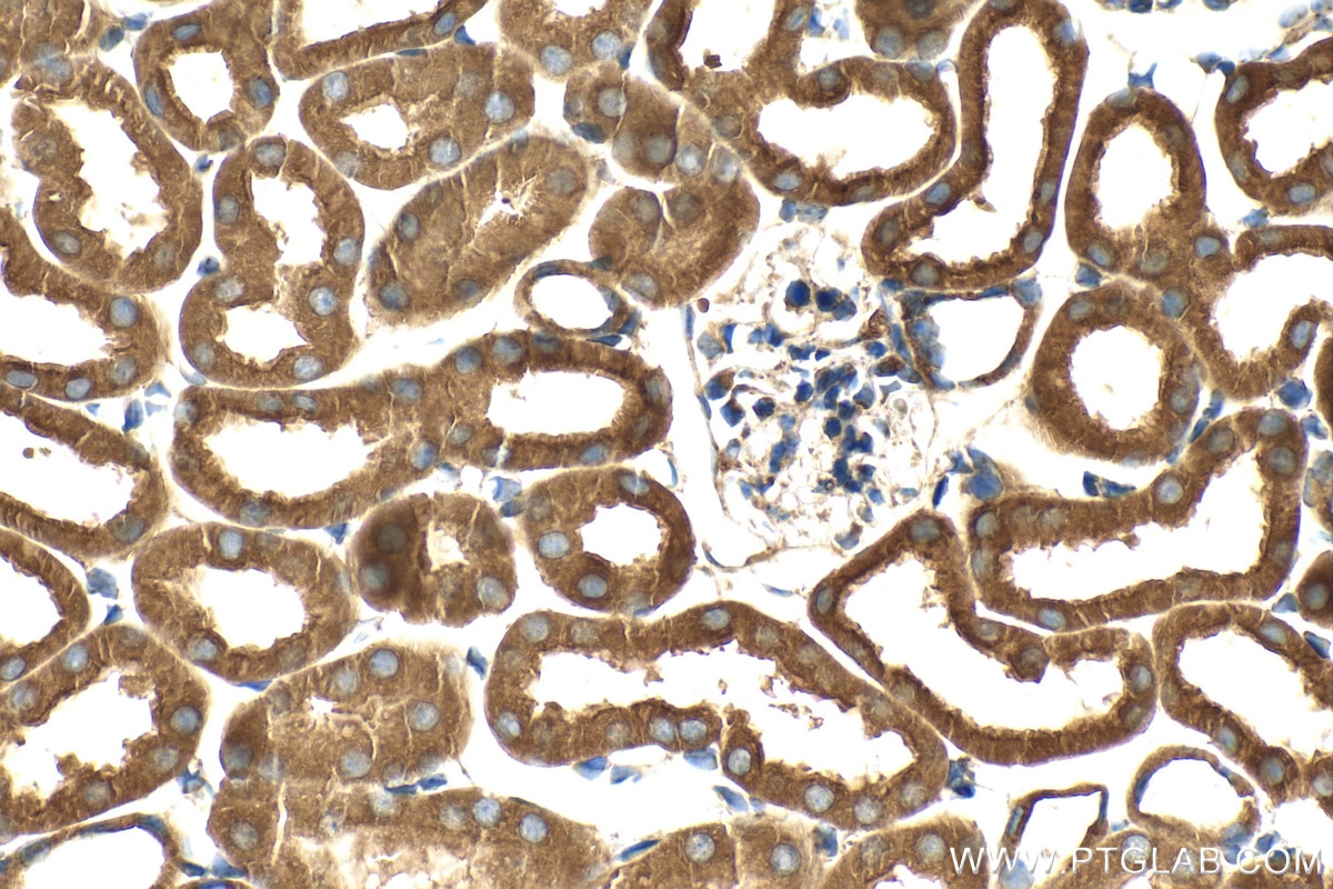 Immunohistochemistry (IHC) staining of mouse kidney tissue using Multi-rAb™ RAB7A Multi-Recombinant antibody (RMX00029)