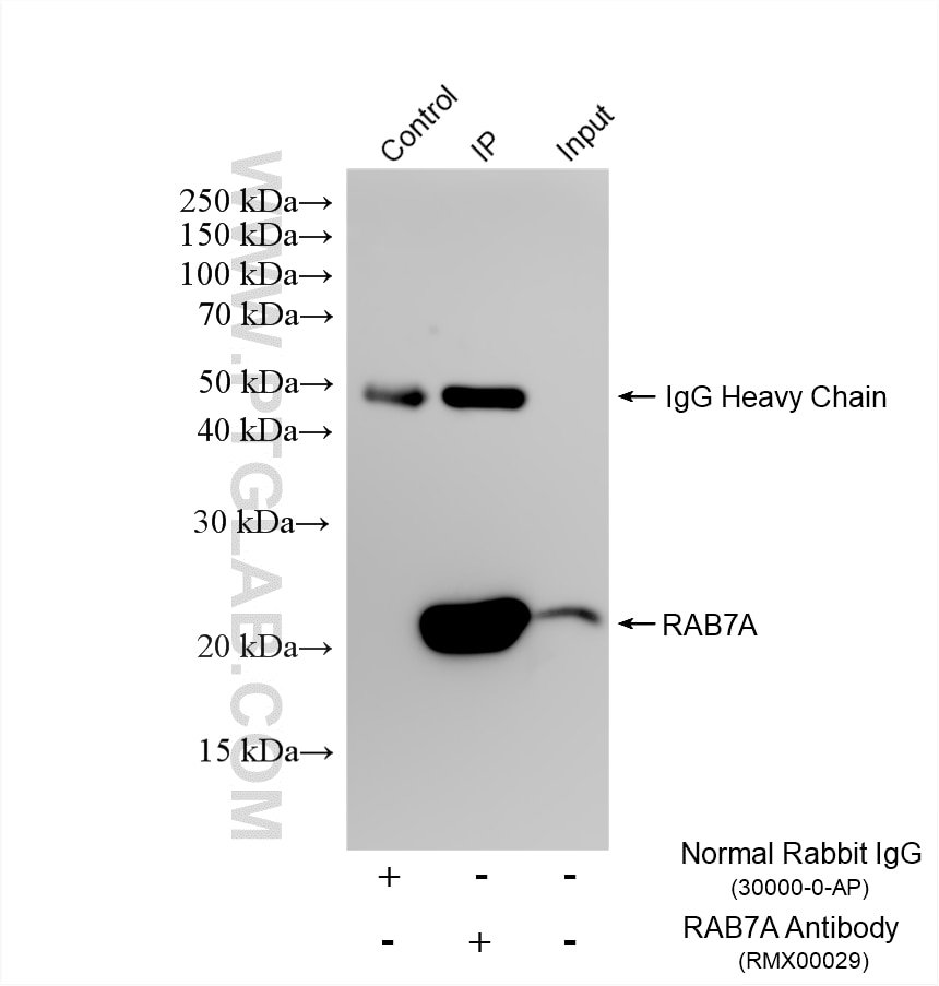 Immunoprecipitation (IP) experiment of mouse brain tissue using Multi-rAb® RAB7A Multi-Recombinant antibody (RMX00029)