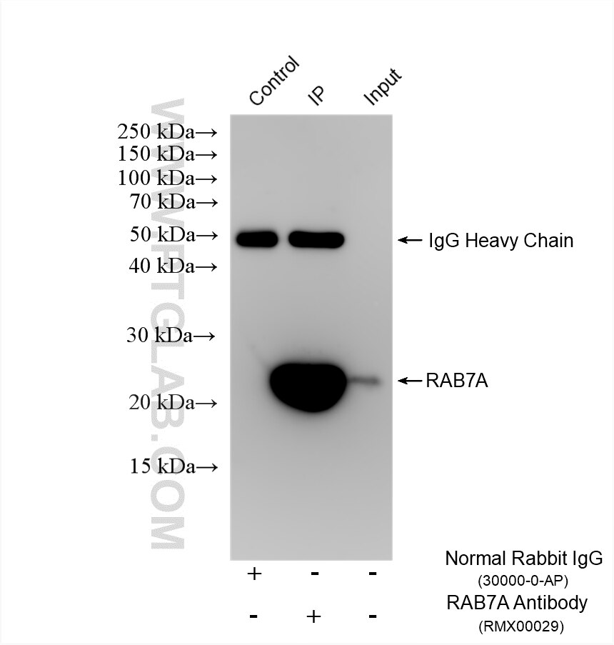 Immunoprecipitation (IP) experiment of SH-SY5Y cells using Multi-rAb® RAB7A Multi-Recombinant antibody (RMX00029)