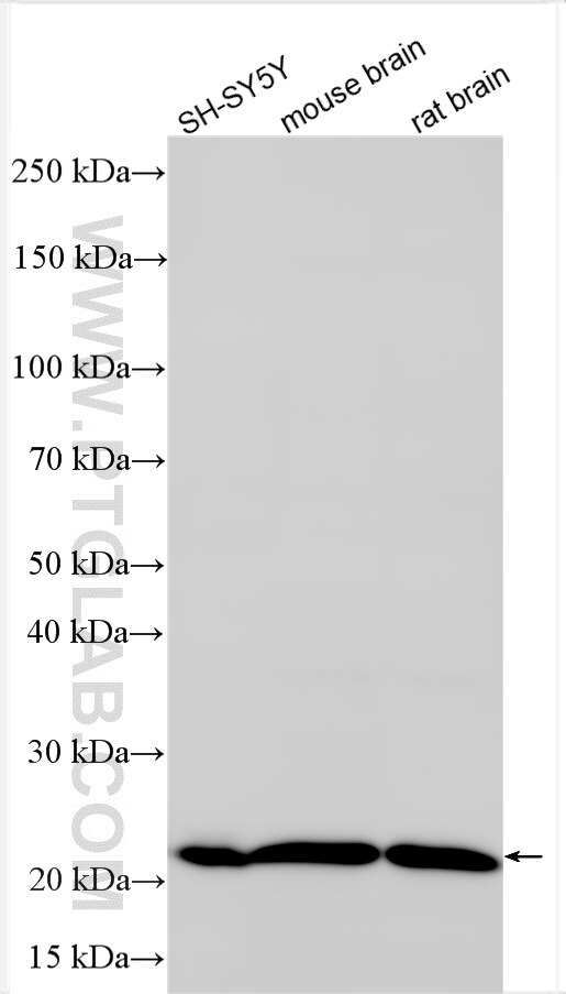 Western Blot (WB) analysis of various lysates using Multi-rAb™ RAB7A Multi-Recombinant antibody (RMX00029)