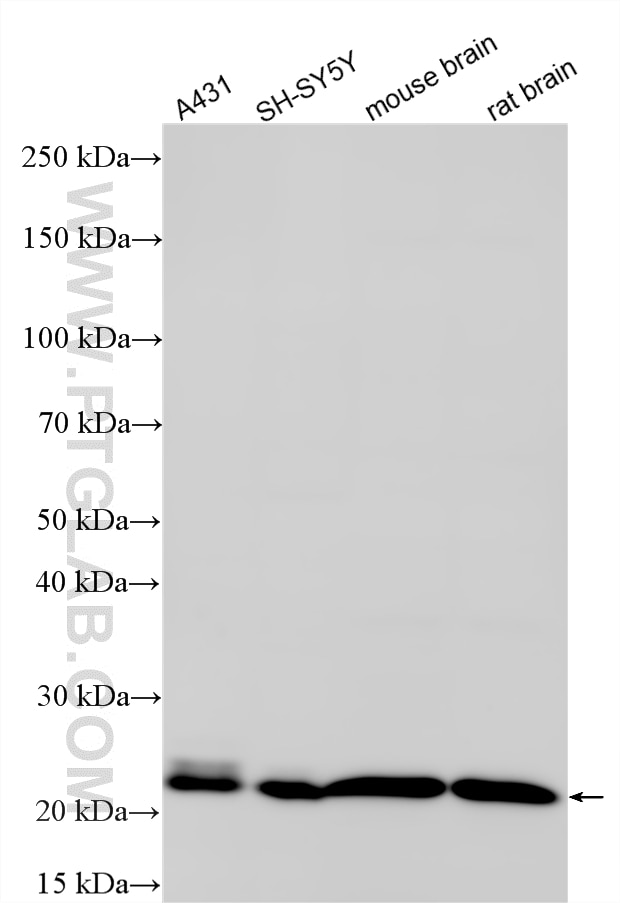 Western Blot (WB) analysis of various lysates using Multi-rAb® RAB7A Multi-Recombinant antibody (RMX00029)