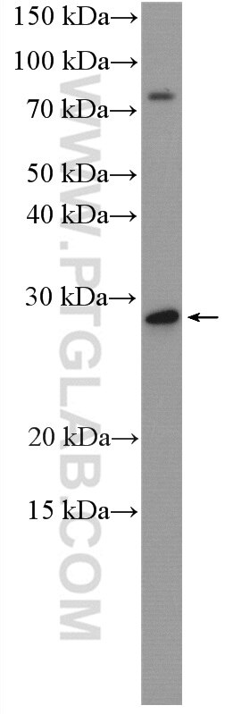 Western Blot (WB) analysis of HEK-293 cells using RAB7B Polyclonal antibody (12283-1-AP)
