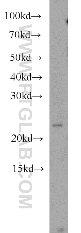 Western Blot (WB) analysis of HeLa cells using RAB7B Polyclonal antibody (12283-1-AP)