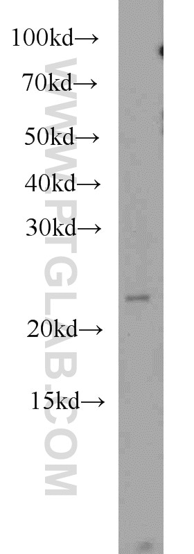 WB analysis of HeLa using 12283-1-AP