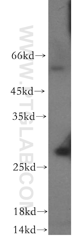 Western Blot (WB) analysis of human heart tissue using RAB7B Polyclonal antibody (12283-1-AP)