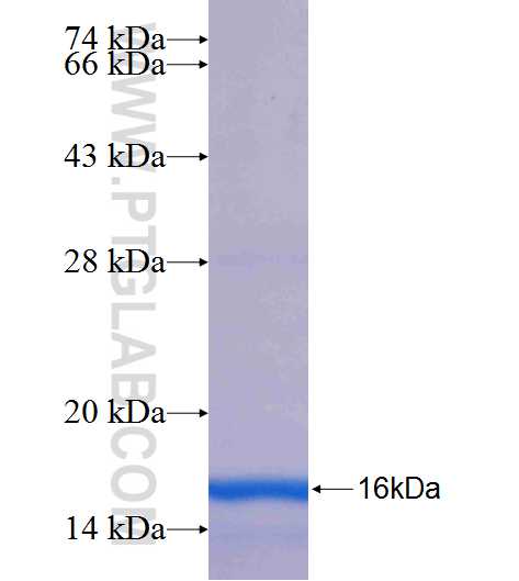 RAB7B fusion protein Ag25035 SDS-PAGE