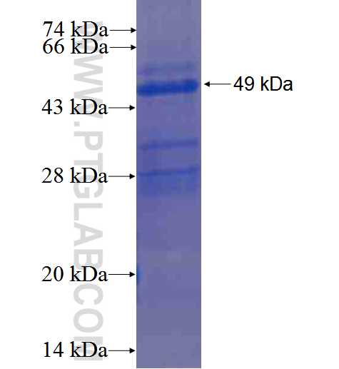 RAB7B fusion protein Ag2936 SDS-PAGE