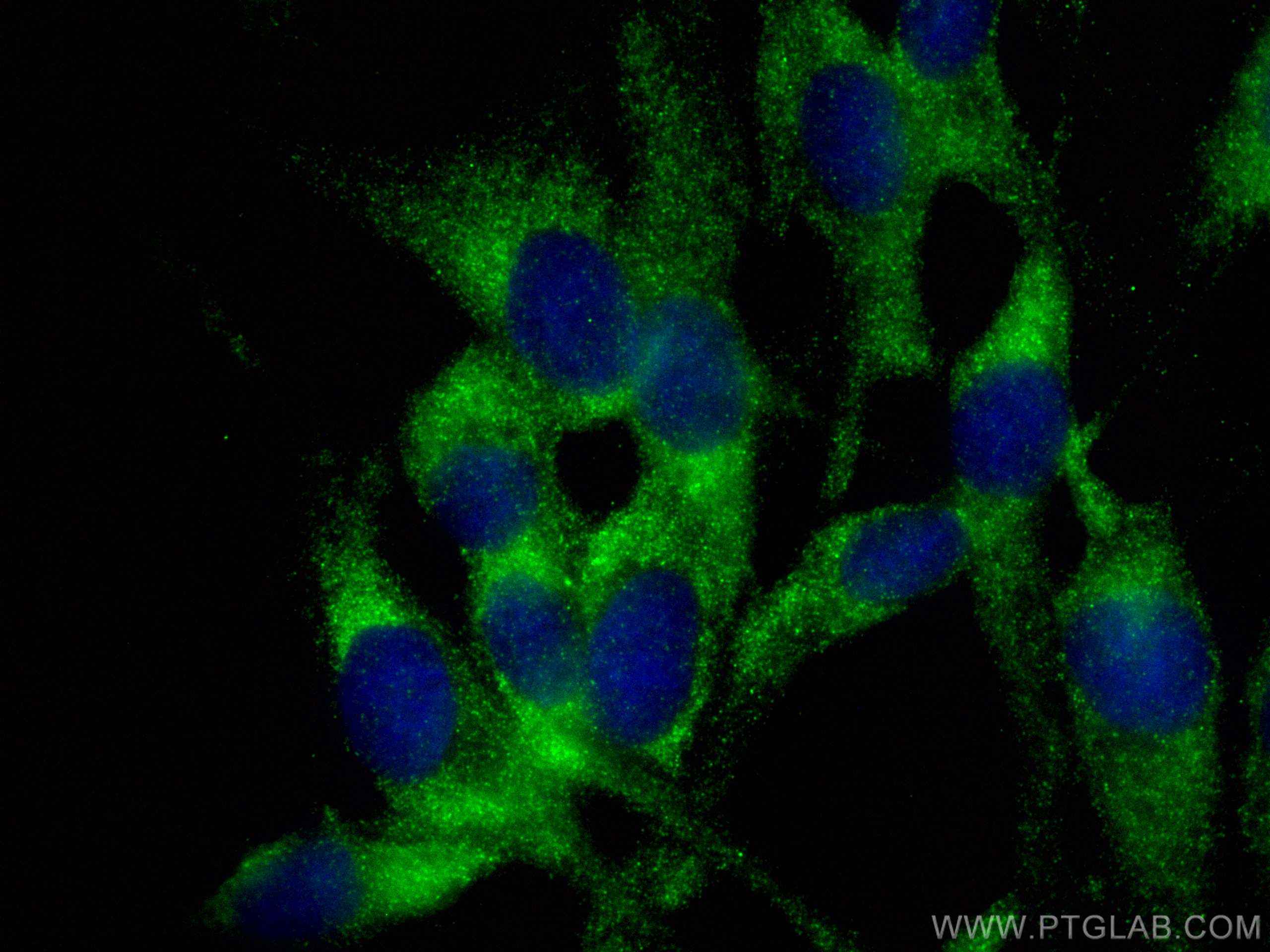 Immunofluorescence (IF) / fluorescent staining of MDCK cells using RAB8A Polyclonal antibody (30636-1-AP)