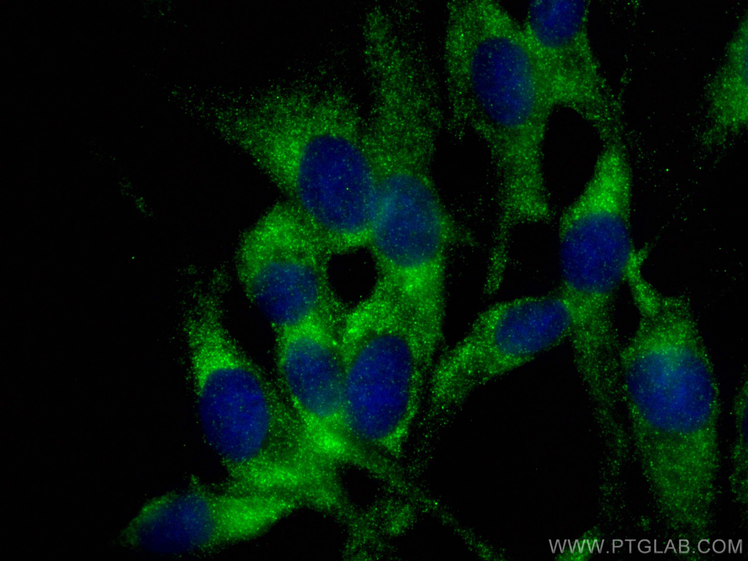 Immunofluorescence (IF) / fluorescent staining of MDCK cells using RAB8A Polyclonal antibody (30636-1-AP)