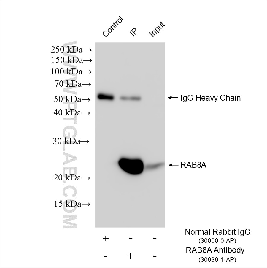 IP experiment of HeLa using 30636-1-AP Immunoprecipitation (IP) experiment of HeLa cells using RAB8A Polyclonal antibody (30636-1-AP)