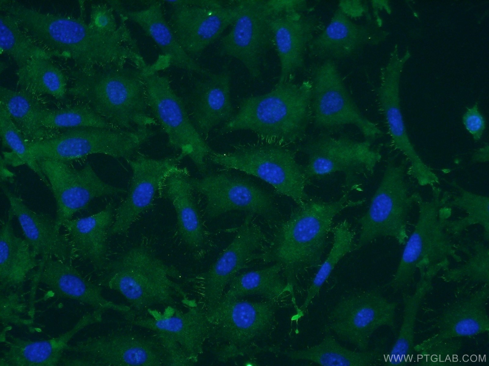 IF Staining of NIH/3T3 using 55296-1-AP