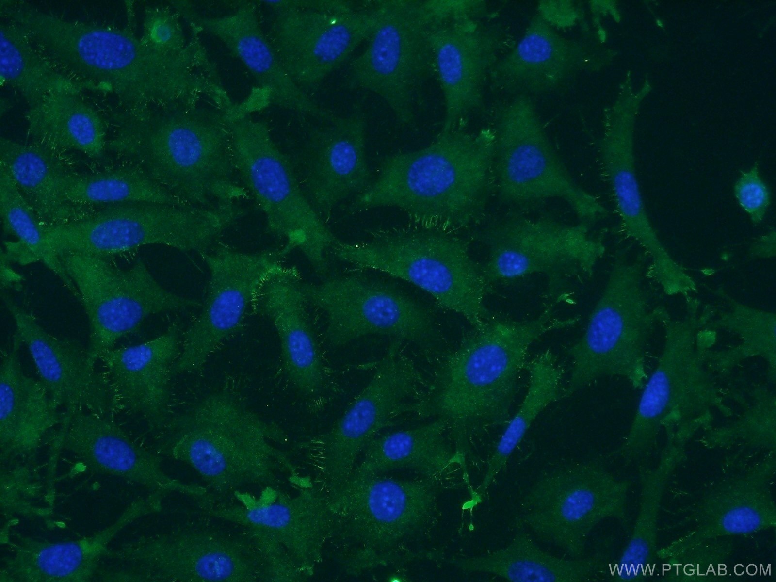 Immunofluorescence (IF) / fluorescent staining of NIH/3T3 cells using RAB8A Polyclonal antibody (55296-1-AP)